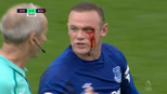 Zagueiro sobe com o cotovelo aberto e faz Rooney 'chorar sangue'; juiz segue o jogo Zagueiro sobe com o cotovelo aberto e faz Rooney 'chorar sangue'; juiz segue o jogo
